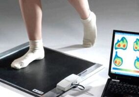 Diagnóstico del hallux valgus