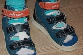 usar sandalias para hallux valgus en un niño