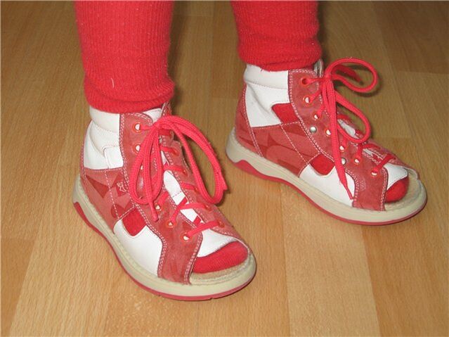 zapatos para niños con hallux valgus