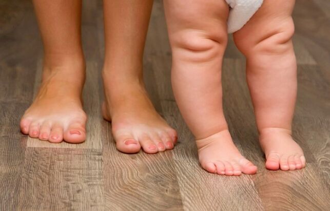 Valgus Deformación del pie en niños